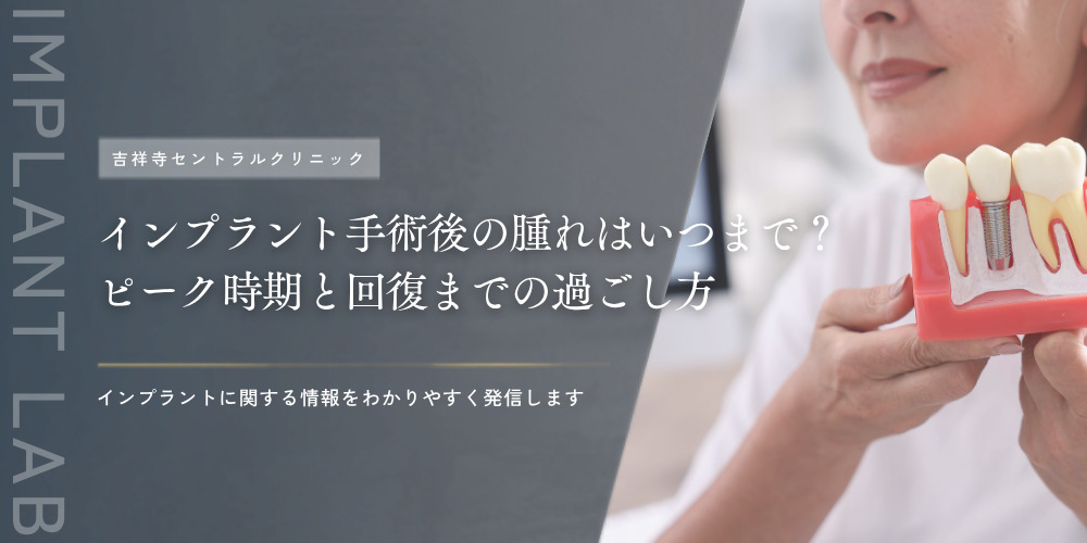 インプラント手術後の腫れはいつまで？ピーク時期と回復までの過ごし方