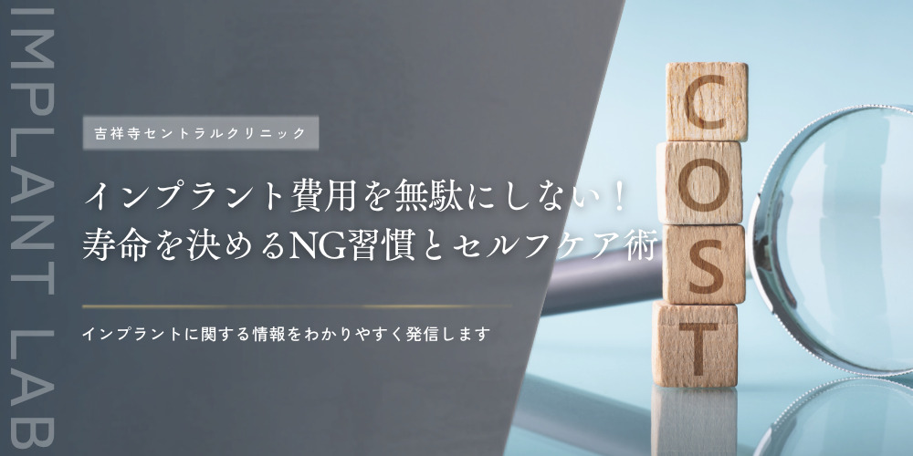 インプラント費用を無駄にしない！寿命を決めるNG習慣とセルフケア術