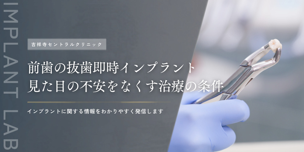 前歯の抜歯即時インプラント｜見た目の不安をなくす治療の条件
