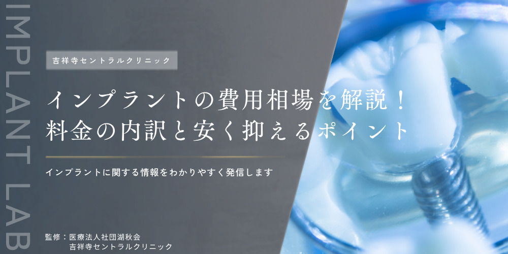 インプラントの費用相場を解説！料金の内訳と安く抑えるポイント