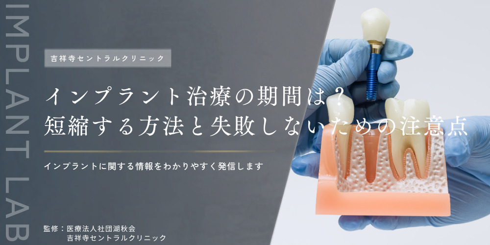 インプラント治療の期間は？短縮する方法と失敗しないための注意点