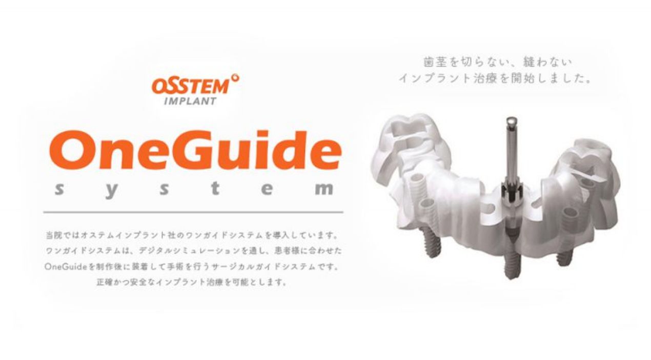 オステム製「OneGuide（ワンガイド）」によるサージカルガイドシステム